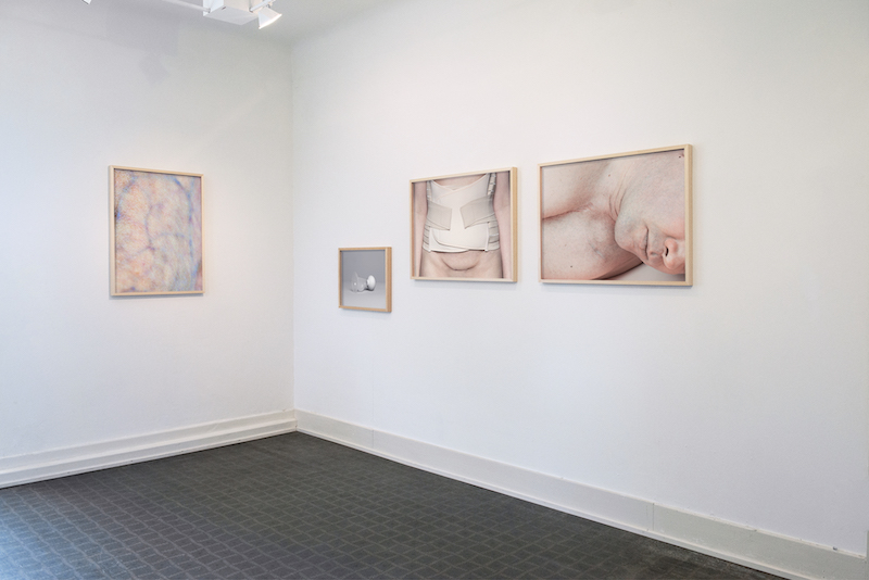 photographs of fragmented body parts are mounted on a gallery wall